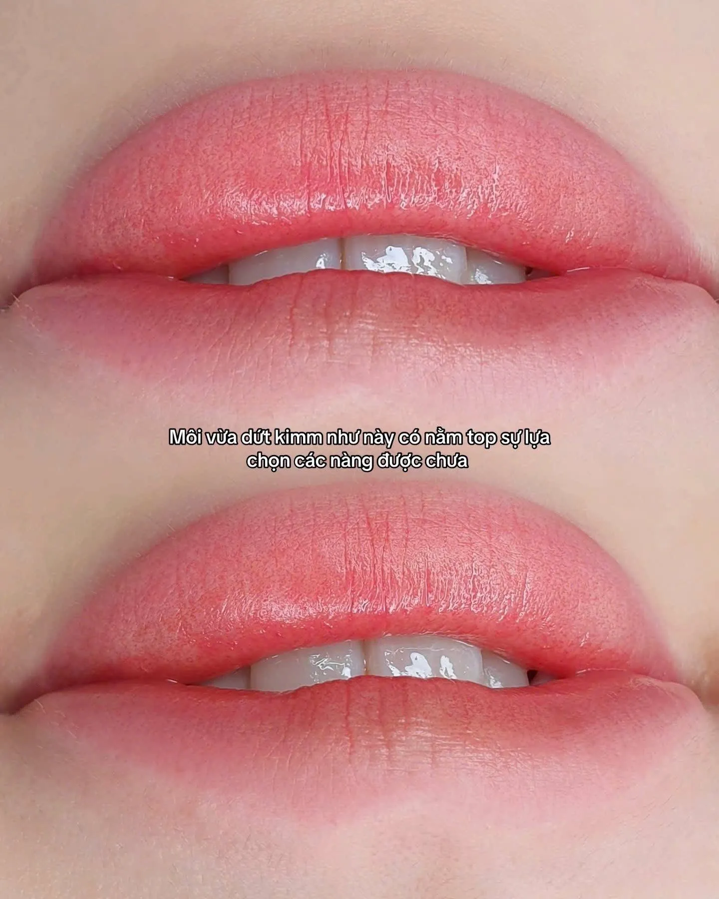 Khách hàng thực tế tại Sunrise Beauty